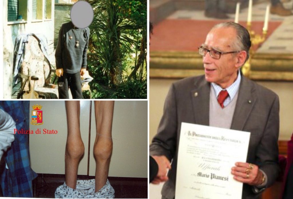 Mario Pianesi, le foto di alcune vittime malnutrite e con le stampelle
