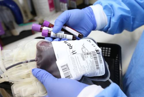Coronavirus: plasma iperimmune, riprendono vigore donazione e sperimentazione