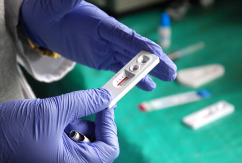 Hiv, al check point di Ancona 1.446 test. Franco, malato Aids: «La prevenzione è fondamentale»